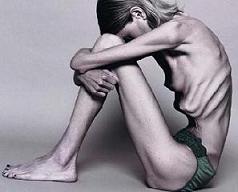20060921012334-anorexia.jpg